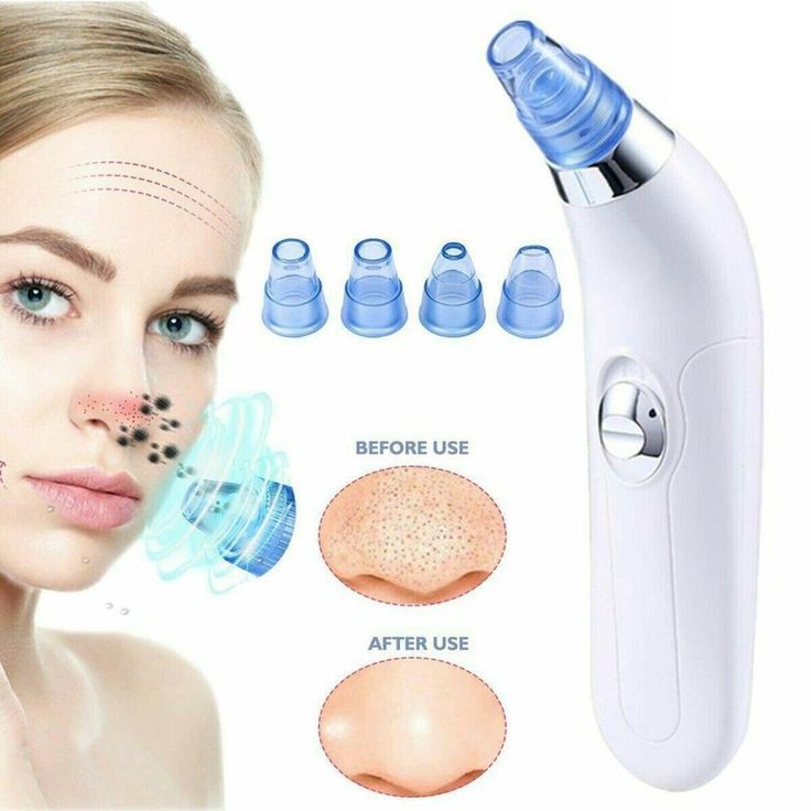 Blackheads Removal Machine